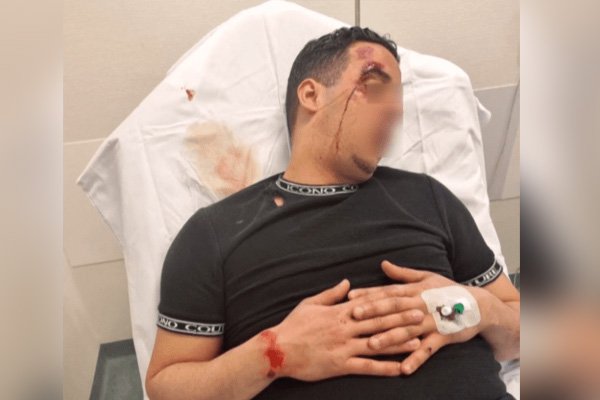 Wie trapte Jamal van zijn brommer in Arnhem?